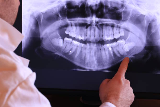 Best Emergency Root Canal Treatment in Laredo, TX